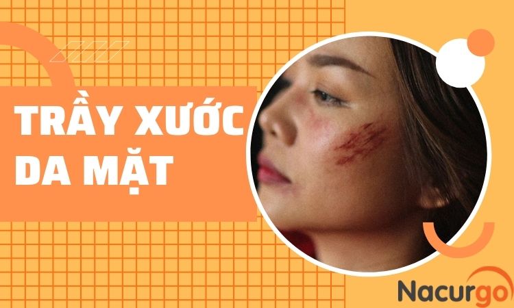 Bị trầy da mặt nên bôi gì giúp da nhanh lành, tránh để lại sẹo?