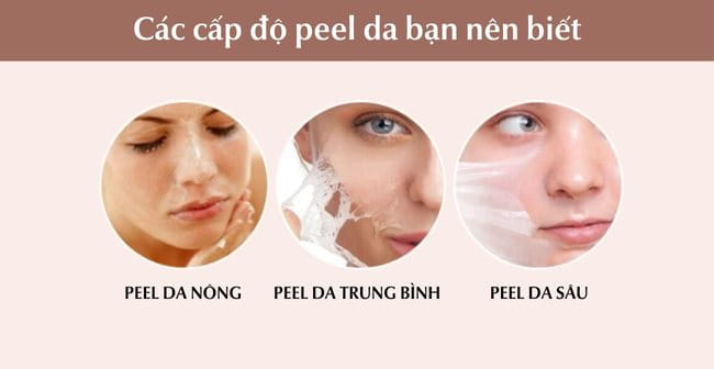 Peel Da Là Gì? Có Tốt Không? Quy Trình Peel Da Chuẩn Y Khoa A-Z