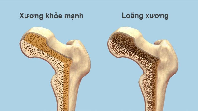 13 tác dụng của mùi tây đối với sức khỏe bạn cần biết