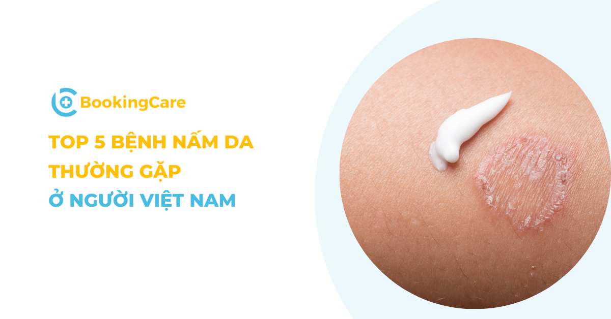 5 bệnh nấm da thường gặp ở người Việt Nam