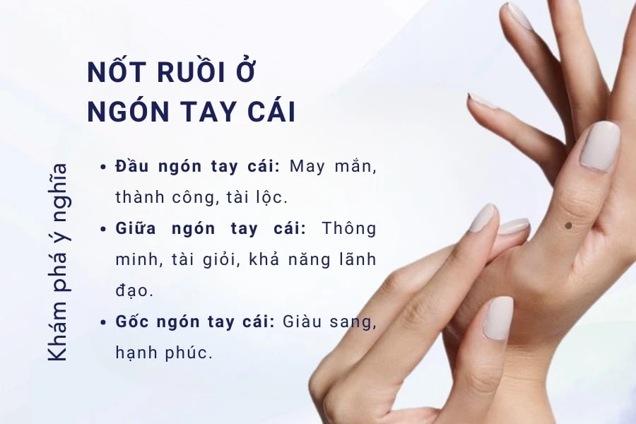 Nam, nữ có nốt ruồi ở ngón tay tốt hay xấu? Có nên xóa không?