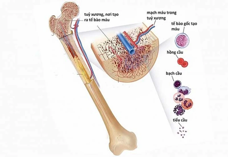 Da nổi chấm đỏ như nốt ruồi son không ngứa là do đâu? Cách điều trị ra sao?