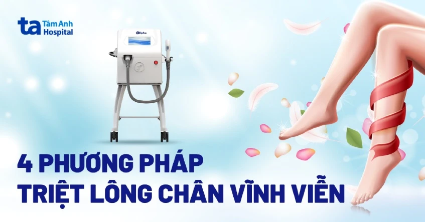 Triệt lông chân vĩnh viễn là gì? 4 cách được ưa chuộng hiện nay