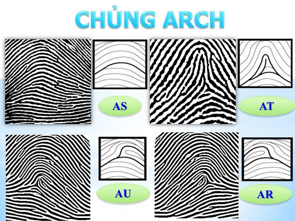 Các chủng vân tay chính và ý nghĩa đặc trưng của chúng