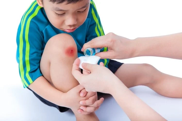 Cách cầm máu khi bị đứt tay hiệu quả và an toàn