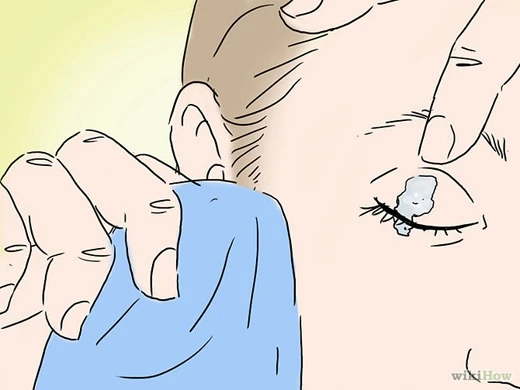 Cách tẩy keo 502 bám vào tay cực nhanh và an toàn