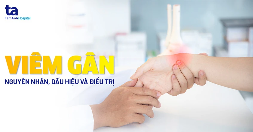 Viêm gân: Nguyên nhân, dấu hiệu, điều trị, phòng ngừa