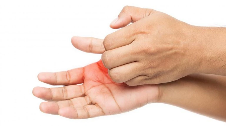 Ngứa tay: Nguyên nhân và cách khắc phục hiệu quả
