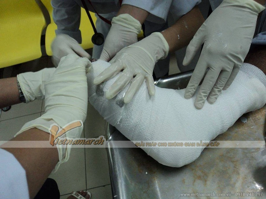 Thạch cao là gì? Công thức hóa học của thạch cao